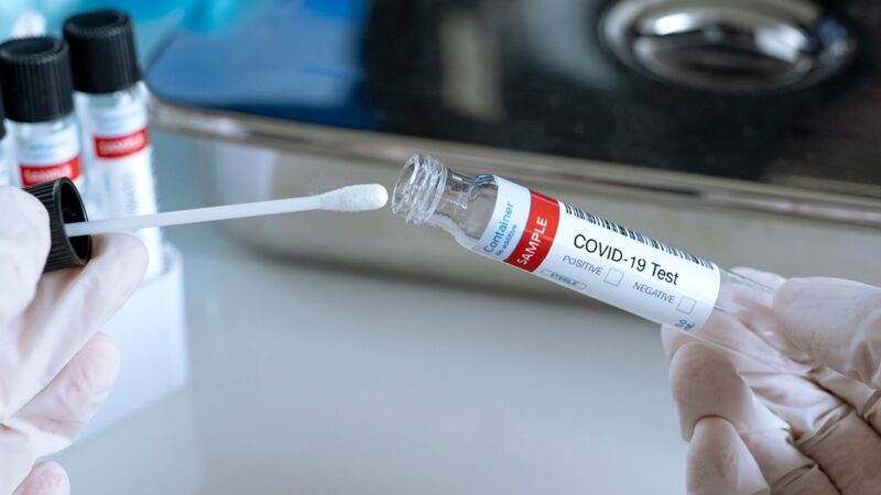 Santé : Le test COVID-19 supprimé en RDC pour les personnes totalement vaccinées